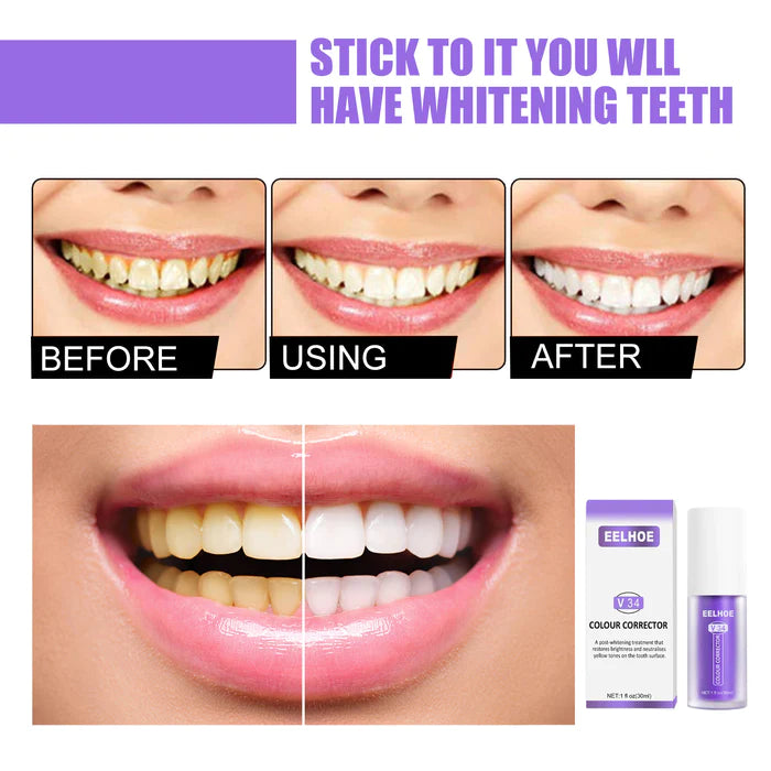 EELHOE V34 Teeth Whitening Solution